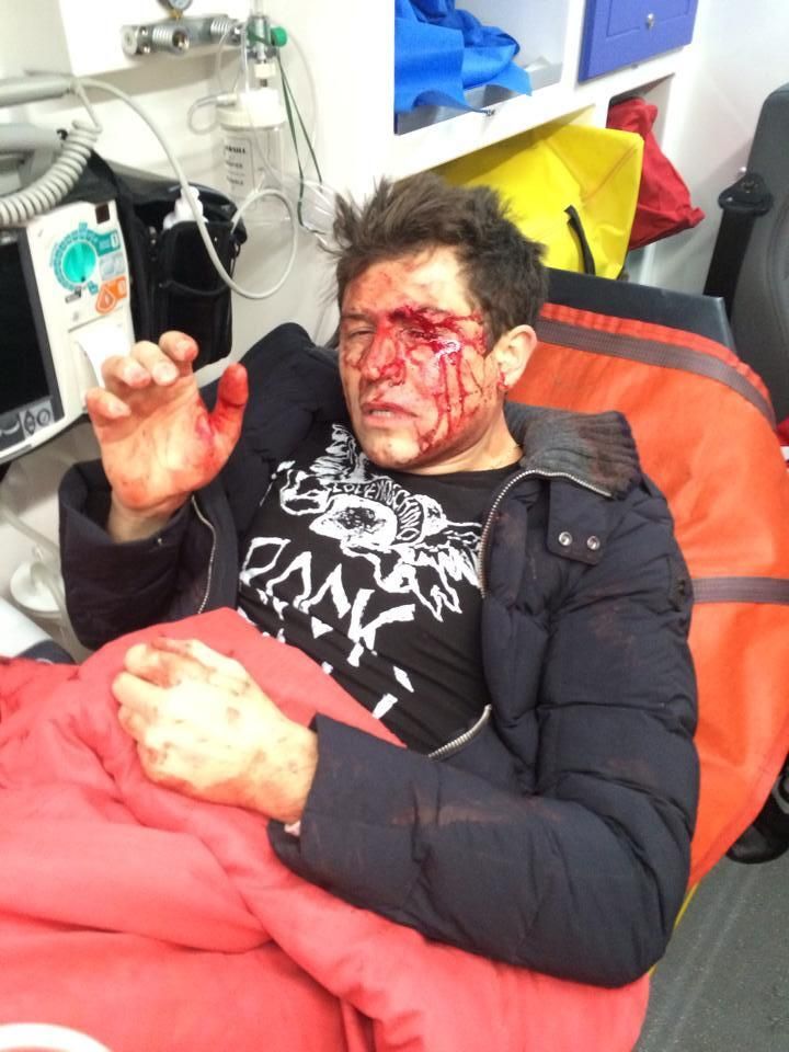 Андрея Джеджулу жестоко избили в Киеве [Фото]