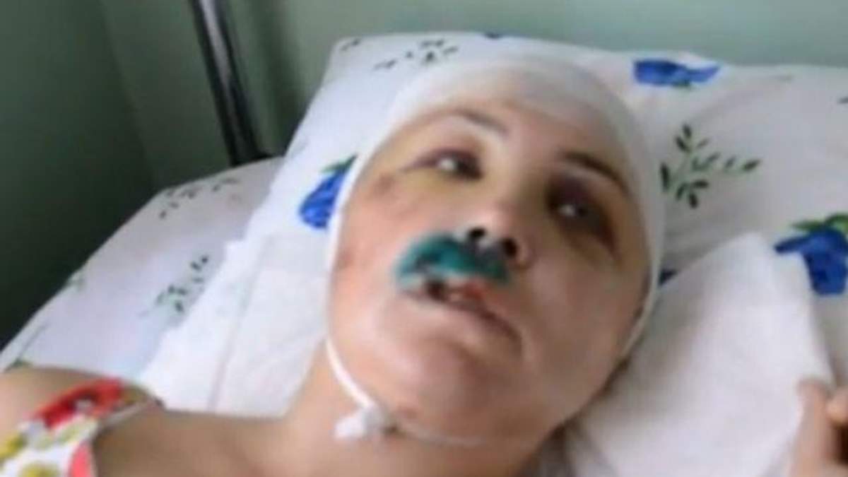 На Миколаївщині двоє міліціонерів зґвалтували дівчину і проламали їй череп