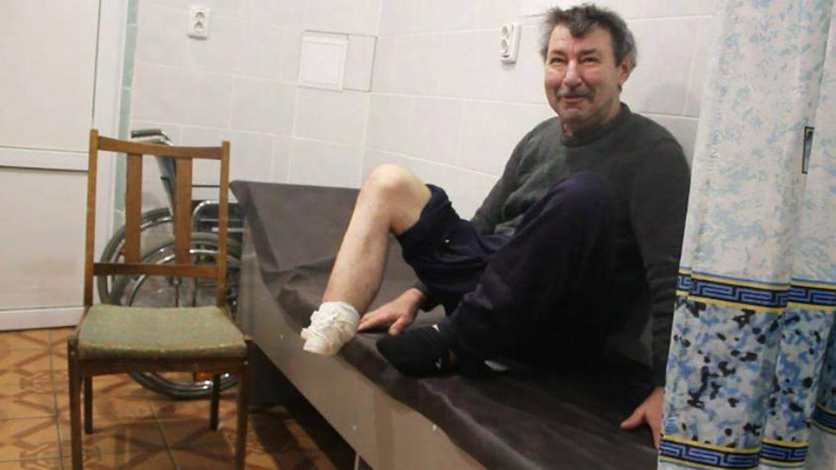 Не міг оплатити собі лікування: на Сумщині чоловік сам собі відрізав ступню через гангрену