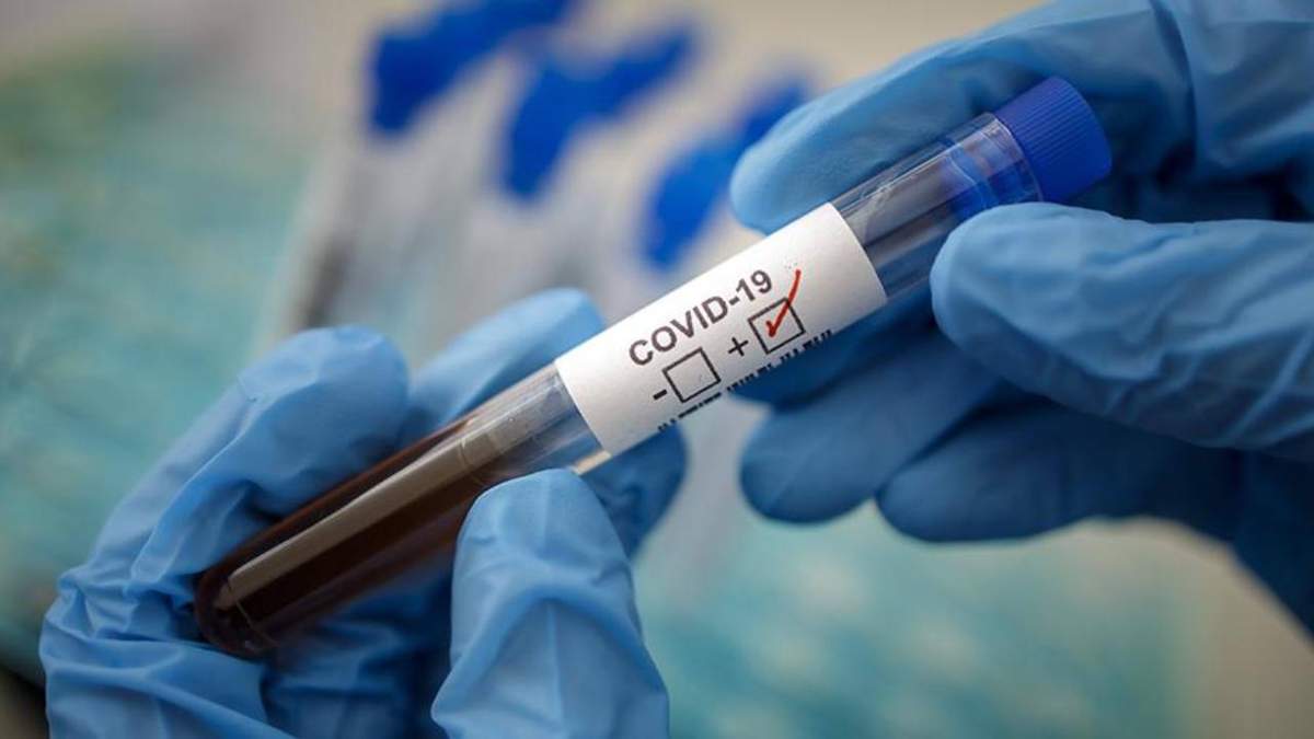 На території Доманівської селищної ради виявлено нові випадки захворювання на коронавірус COVID-19