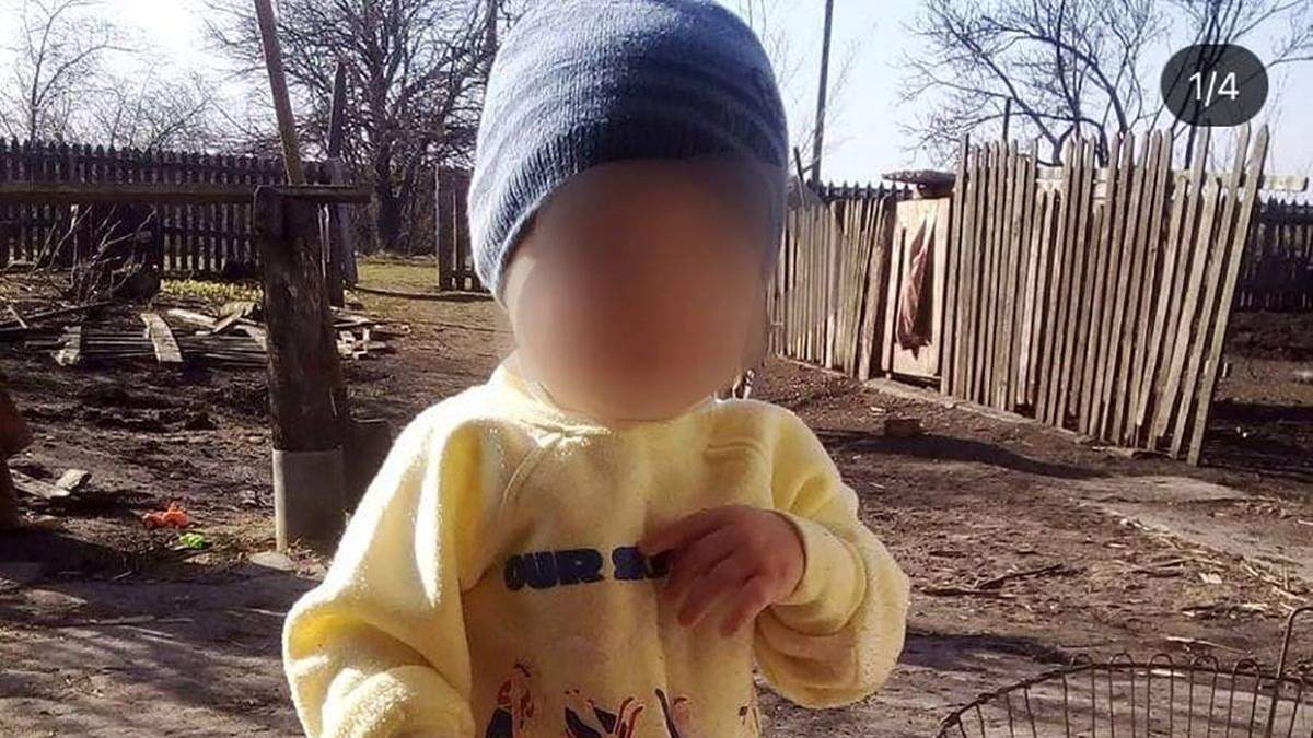 У 2-річного хлопчика, якого порізав вітчим у Дніпрі, відмовив мозок
