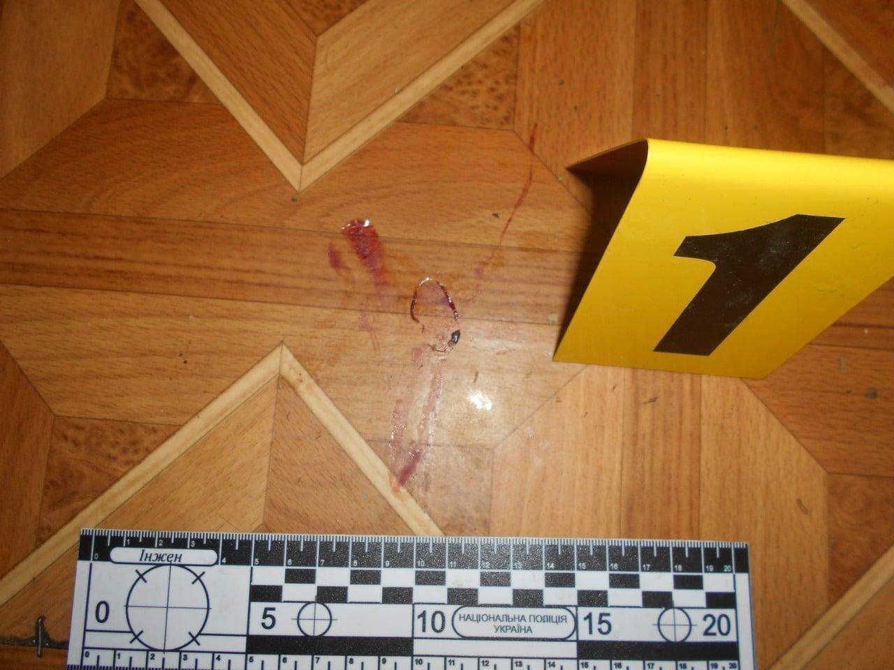 Зламав усі ребра: на Львівщині п'яний чоловік вбив власного батька – фото