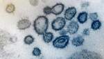 Нашли суперантитело против коронавируса: чем оно особенное