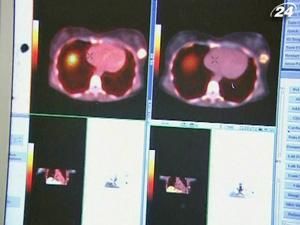 Радіоактивні маячки допомагають лікарям ефективніше боротися з раком Радіоактивні маячки допомагають лікарям ефективніше боротися з раком