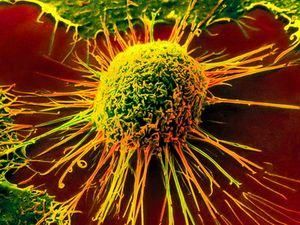 Вчені знайшли новий механізм знищення ракових клітин