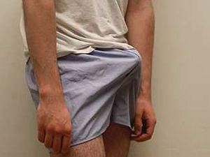 Домініканець пережив рекордно довгу ерекцію Домініканець пережив рекордно довгу ерекцію