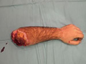 Американець відрізав свою руку, яка застрягла у печі Американець відрізав свою руку, яка застрягла у печі