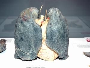 У Британії жінка померла через легені курця У Британії жінка померла через легені курця