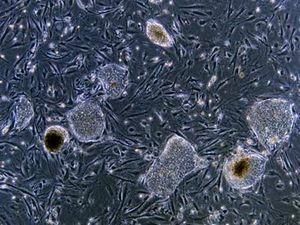 Американським вченим вперше вдалося виростити печінку Американським вченим вперше вдалося виростити печінку