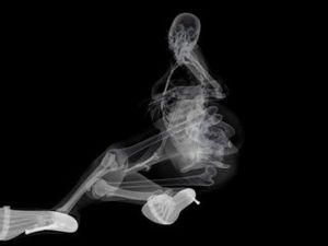 Створено календар із рентгенівськими знімками голих моделей Створено календар із рентгенівськими знімками голих моделей