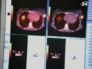 Науковці винайшли ліки, які можуть зупинити генетичні форми раку Науковці винайшли ліки, які можуть зупинити генетичні форми раку