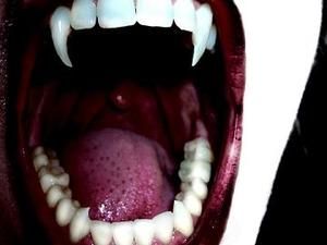 Фанатка "Сутінок" вставила собі вампірські ікла Фанатка "Сутінок" вставила собі вампірські ікла