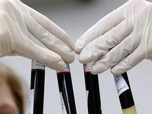 Україна випередила Африку за темпами поширення СНІДу Україна випередила Африку за темпами поширення СНІДу