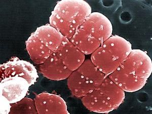 Вчені знайшли бактерій здатних витримати вакуум Вчені знайшли бактерій здатних витримати вакуум