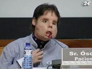 Чоловік, якому пересадили обличчя, показався на люди Чоловік, якому пересадили обличчя, показався на люди