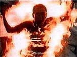 У Мелітополі співмешканець облив жінку бензином і підпалив У Мелітополі співмешканець облив жінку бензином і підпалив