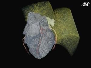 Новий метод діагностування серцево-судинних захворювань