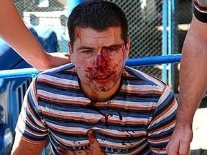 ЗМІ: лідера одеської "Родіни" порізали у ресторані ЗМІ: лідера одеської "Родіни" порізали у ресторані