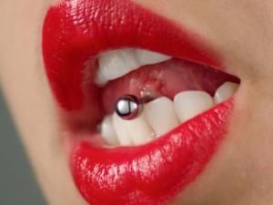 Проколювання язика може стати причиною руйнування зубів Проколювання язика може стати причиною руйнування зубів