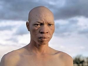 Танзанія: кенієць отримав 17 років за спробу продати людину-альбіноса на органи Танзанія: кенієць отримав 17 років за спробу продати людину-альбіноса на органи