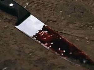 Одеса: невідомий нападник поранив ножем бійця МВС