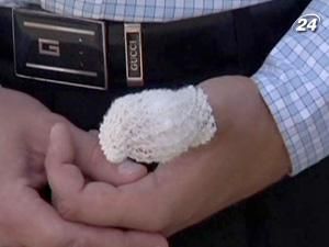 Водій відкусив палець інспектору ДАІ Водій відкусив палець інспектору ДАІ