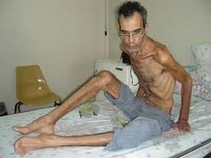 У Венесуелі помер фермер, який голодував проти політики Президента Чавеса У Венесуелі помер фермер, який голодував проти політики Президента Чавеса