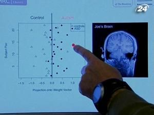 Британці розробили новий метод діагностики аутизму Британці розробили новий метод діагностики аутизму