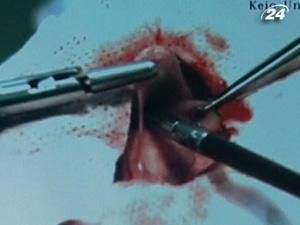 Нову хірургічну систему обладнали тактильними сенсорами Нову хірургічну систему обладнали тактильними сенсорами