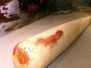 Миколаїв: студент побив міліціонера бейсбольною битою Миколаїв: студент побив міліціонера бейсбольною битою