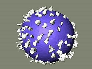 Франція: медики навмисно заразили пацієнта вірусом СНІДу Франція: медики навмисно заразили пацієнта вірусом СНІДу