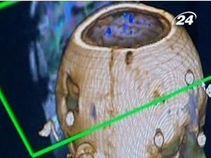 Інновації в лікуванні пухлин Інновації в лікуванні пухлин