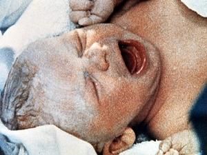 Вчені: діти, яких зачали штучним шляхом, вищі за своїх "звичайних" однолітків Вчені: діти, яких зачали штучним шляхом, вищі за своїх "звичайних" однолітків