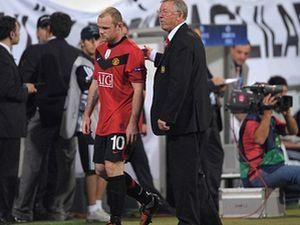 Ферг’юсон про травму Руні Ферг’юсон про травму Руні