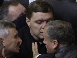 Рада: депутату від БЮТ розсікли брову Рада: депутату від БЮТ розсікли брову
