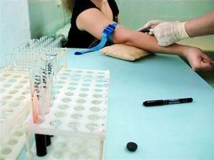 Чверть заражених ВІЛ британців не знають про своє захворювання Чверть заражених ВІЛ британців не знають про своє захворювання