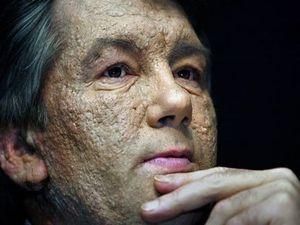 Москаль: Ющенко не отруївся, а передозувався алкоголем Москаль: Ющенко не отруївся, а передозувався алкоголем
