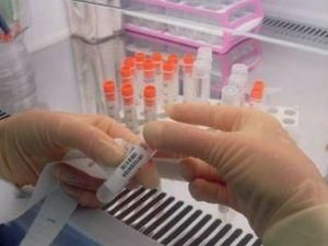 У Німеччині вилікували СНІД У Німеччині вилікували СНІД