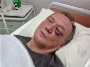 Побитий білоруський кандидат у президенти опинився в ізоляторі КДБ Побитий білоруський кандидат у президенти опинився в ізоляторі КДБ