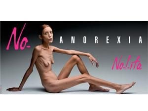 Померла Ізабель Каро - символ боротьби з анорексією