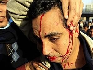 ЗМІ: Сьогодні в Каїрі внаслідок сутичок загинули кілька людей ЗМІ: Сьогодні в Каїрі внаслідок сутичок загинули кілька людей