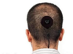 Американському художнику довелось позбутись від камери в потилиці Американському художнику довелось позбутись від камери в потилиці