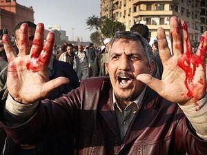 Медики: Кількість постраждалих У Лівії наближається до тисячі Медики: Кількість постраждалих У Лівії наближається до тисячі