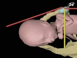 AMOLAB позволяет наблюдать за ходом родов в реальном времени AMOLAB позволяет наблюдать за ходом родов в реальном времени