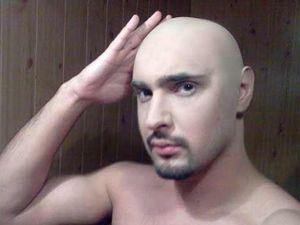 У Віталія Козловського лиса голова У Віталія Козловського лиса голова