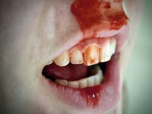 В Москве задержали людоеда В Москве задержали людоеда