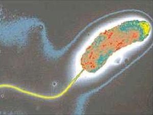 Холера поширюється за межі Маріуполя