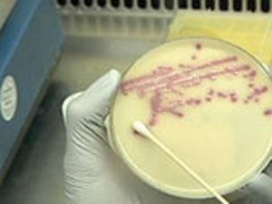 В Германии пик кишечной инфекции прошел В Германии пик кишечной инфекции прошел