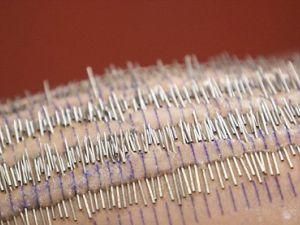 Американку прокололи 3200 раз (ФОТО) Американку прокололи 3200 раз (ФОТО)