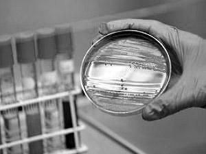 35 людей стали жертвами кишкової інфекції в Німеччині 35 людей стали жертвами кишкової інфекції в Німеччині